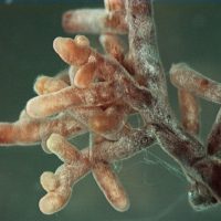 Mycorrhizal_root_tips_amanita